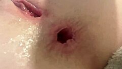 Preparation and stretching of the anal hole with a plug