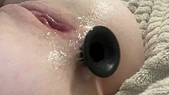 Preparation and stretching of the anal hole with a plug