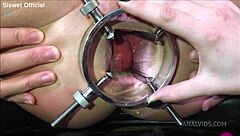 Wrecked Asshole Bulges Belly