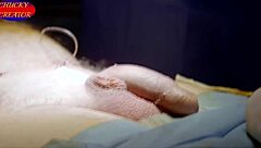 My story of penile enlargement surgery for girth and length at 8495