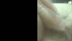 My story of penile enlargement surgery for girth and length at 8495