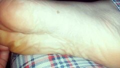 Nicoletta Walked Barefoot All Day, Her Feet Are Destroyed