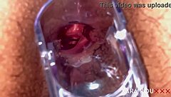 i'm using a speculum to show my gaping anal hole