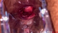 i'm using a speculum to show my gaping anal hole