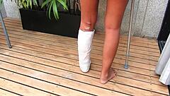 car accident leaves her in short cast leg