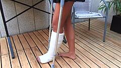 car accident leaves her in short cast leg