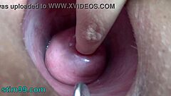 Extreme german electro cervix insertion solo