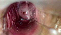 Vaginal Orgasm Intensifies with Speculum Play