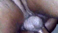 Doctor treats patient with chocolate glaze