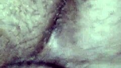 Doctor treats patient with chocolate glaze